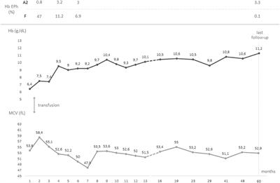 Case Report: Clinical and Hematological Characteristics of εγδβ Thalassemia in an Italian Patient